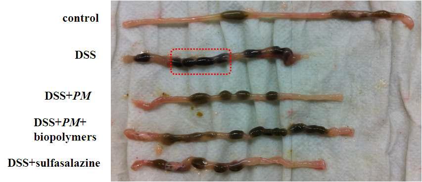 Images of the large intestine length in inflammatory bowel disease mice induced by DSS