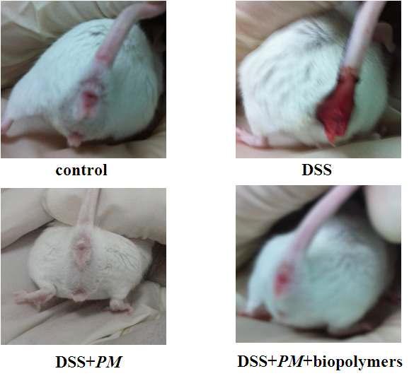 Images of the anus in inflammatory bowel disease mice induced by DSS