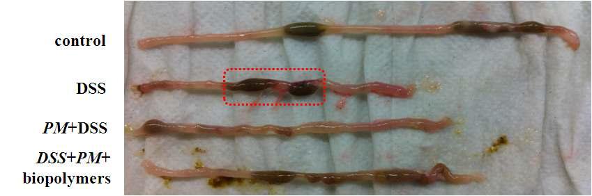 Images of the large intestine length in inflammatory bowel disease mice induced by DSS