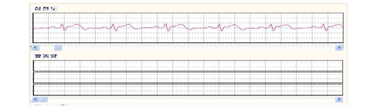 수신된 심전도 데이터 그래프로 출력