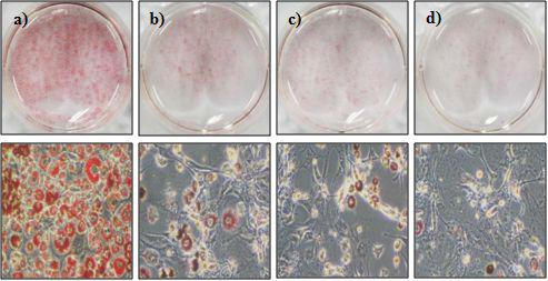 Effect of mixture of NN and EJ extracts on lipid accumulation during adipogenic differentiation.