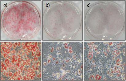 Effect of mixture of NN and EJ extracts and GC extract on lipid accumulation during adipogenic differentiation.