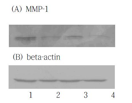 MMP‐1 유전자 발현의 western blotting 분석