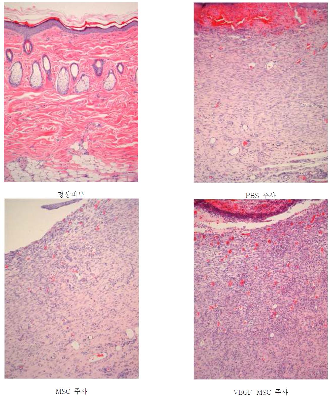 쥐 피부조직에대한 MSC와 VEGF-MSC의 효능차이