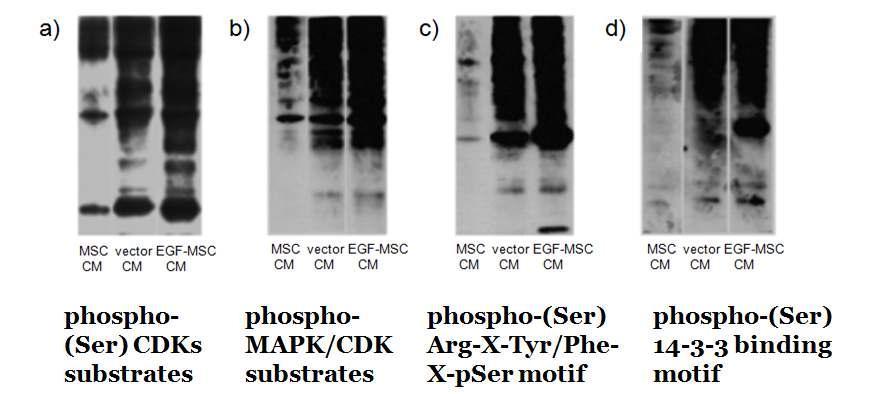 MSC, EGF-MSC 배양액이 피부세포 증식 및 이동 단백질 발현에 미치는 영향