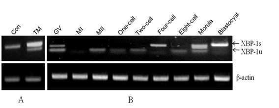 돼지난자와 수정란에서 XBP-1 발현 분석. XBP-1s: spliced form, XBP-1u: unspliced form.