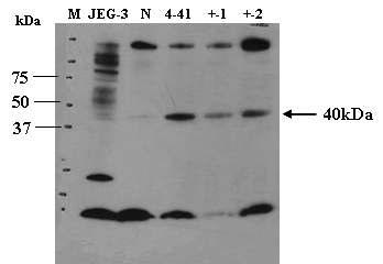 Western blot analysis of normal minipig (PWG), Donor cell (FasL 4-41), and transgenic minipig ear cell (FasL ear).