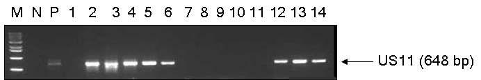 Result of colony PCR using US11 gene specific primer. The PCR products (20ul) followed by electrophoresis on 1% agarose gel. lane M, DNA molecular weight (100bp) marker (bioneer. Ltd) N: Negative control, P: pcDNA3.1/US11 plasmid, lane 1～ 14, selected colony cell line.