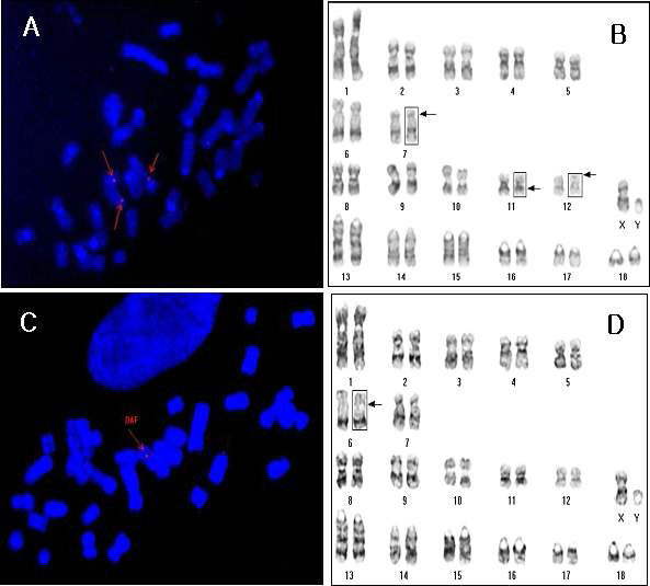 Fluorescence in situ hybridization (FISH) analysis using a rhodamine-labeled probe containing the human DAF gene and karyotyping demonstrated the integration of the cells obtained from 5-81(A, B) and 5-93(C, D) with normal karyotype.