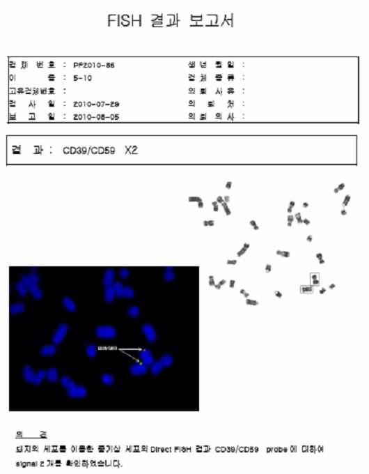 CD39/CD59 clonal cell line 5-10 FISH