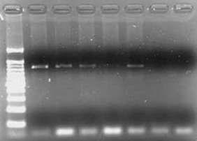 The PCR results for investigation of presence of KNP491C7 PERV location using primers of 3