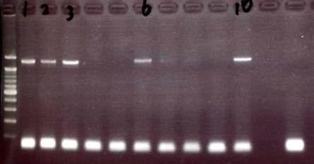 PERV-A/C recombinant type PCR 결과