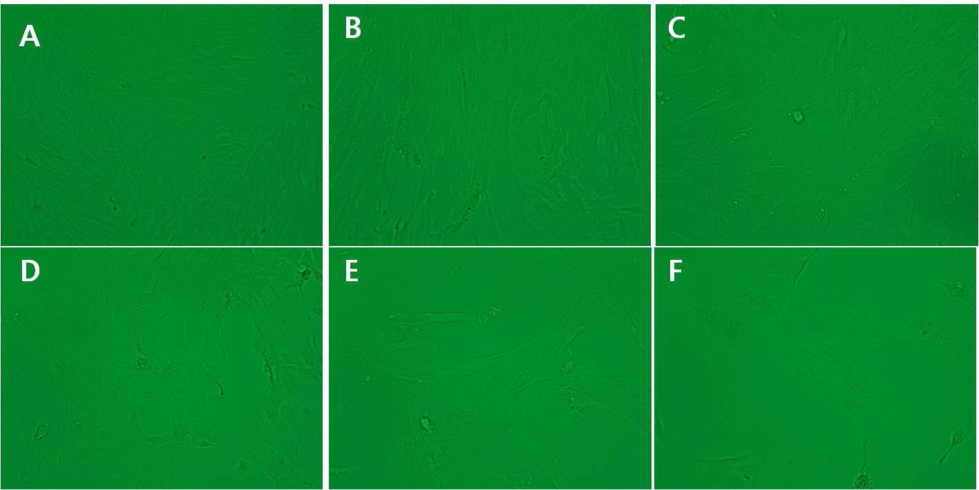 다양한 voltage에 따른 세포 증식 (A)과 GFP 발현 (B)의 차이를 확인. A; control; 0 voltage, B; 100 voltage, C; 150 voltage, D; 200 voltage, E; 250 voltage, F; 300 voltage. 세포는 100배에서 현미경으로 관찰하였고, GFP는 같은 배율에서 형광현미경으로 관찰하였다.