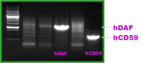 DA F와 CD59유전자 합성