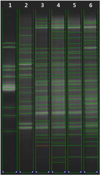 Comparison of bands in the DGGE gel using the UVIband program.