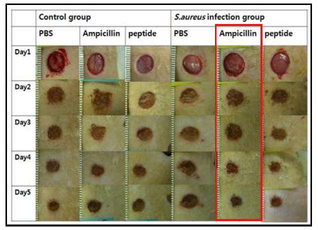 시간경과(5days)에 따른 항균 펩타이드와 타 항생제의 치료 효과 비교