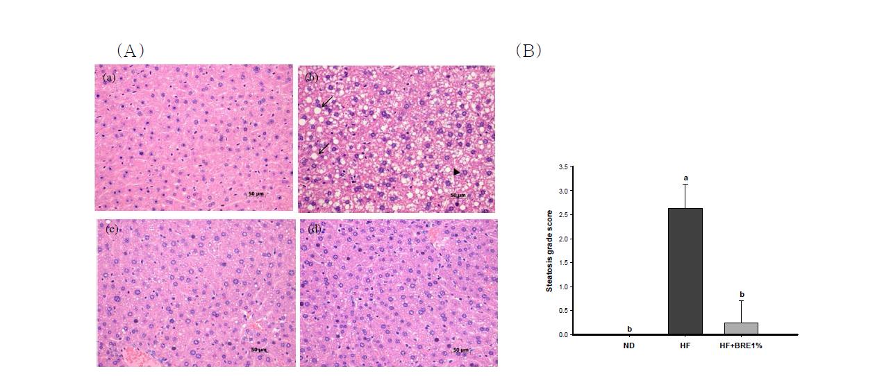 Effect of BRE supplementation on liver histology (A) and steatosis grade (B).