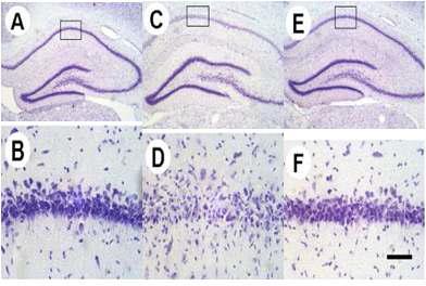 Representative photomicrographs of cresyl violet-stained hippocampal regions of either sham-operated rats(A,B) or rats that had been subjected to 10 min ischemia followed by the treatment with either saline (C,D) or ischemia-induction and DJ(200mg/kg) treated group (E,F).
