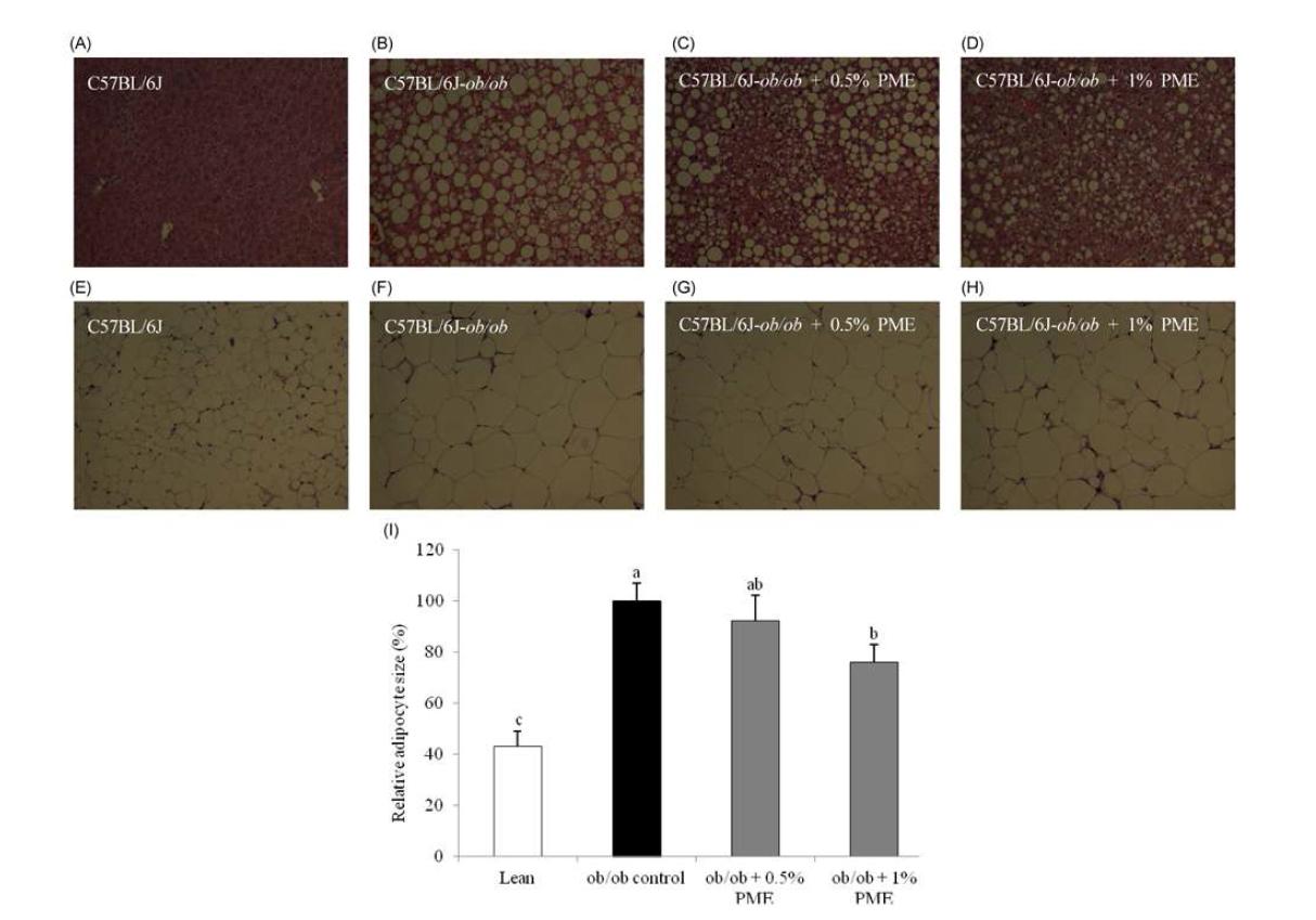 Microphotographs of the liver and white adipose tissue (WAT) in lean and obese mice.