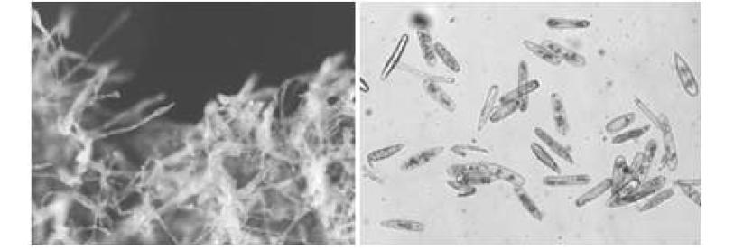 본 연구에서 자연감염 된 흰가루병(Leveillua taurica (Lév.) Arnaud) 의 균사(A)와 포자모양(B).