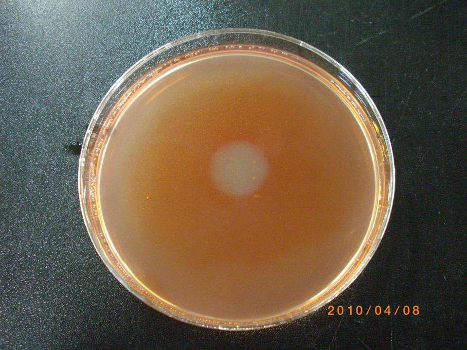 섬유소분해 미생물 선발(2차조사)