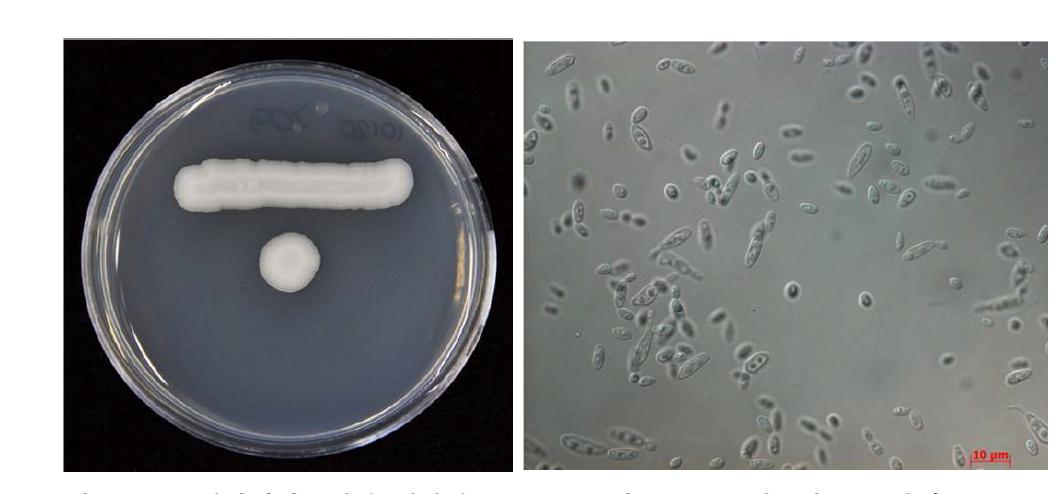 YM 배지에서 5일간 배양한 Y709 균주의 colony (좌) 및 cell 형태