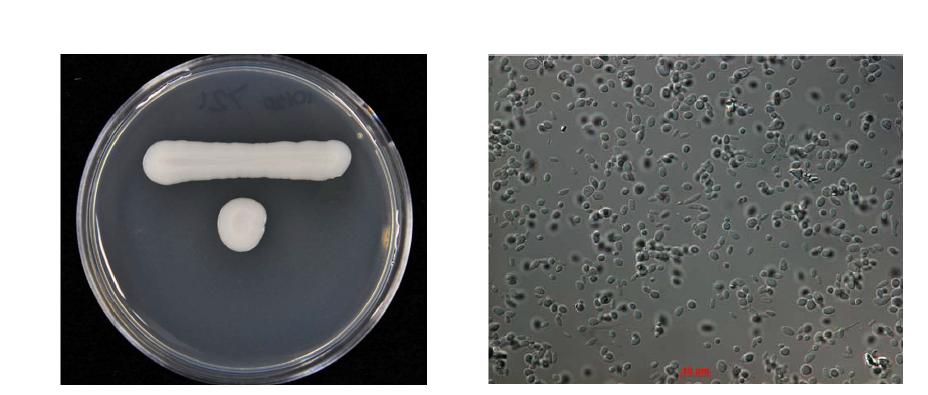 YM 배지에서 5일간 배양한 Y721 균주의 colony (좌) 및 cell 형태