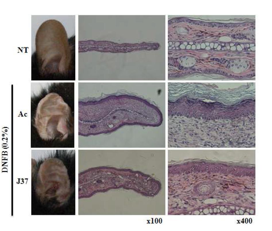 J37의 항아토피 활성. J37을 처리한 군에서 귀의 손상 감소