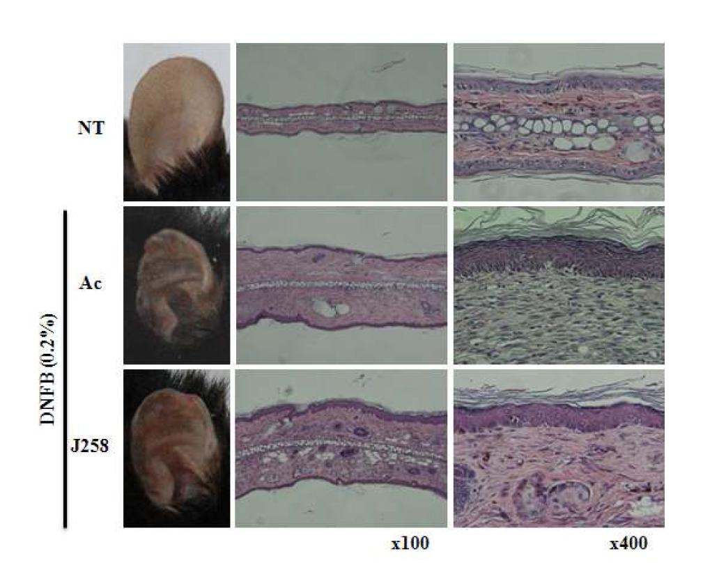 마우스 동물모델을 이용한 J258의 항아토피 활성. HE 염색을 통한 귀상피의 손상을 억제효과