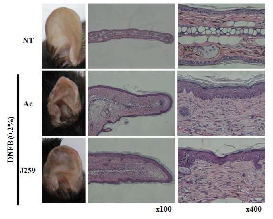 마우스 동물모델을 이용한 J259의 항아토피 활성. HE 염색을 통한 귀상피의 손상을 억제효과