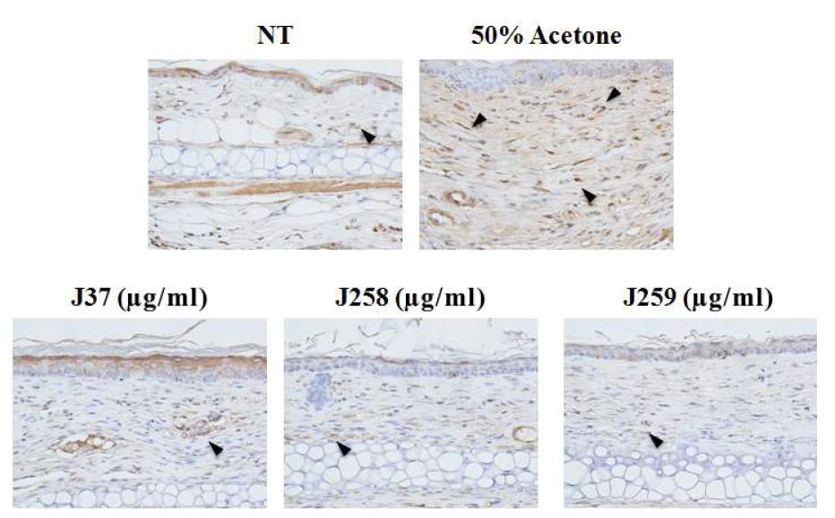 Immunohistochemistry를 이용한 IL-31의 발현 조사