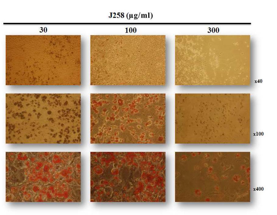 J258의 비만활성을 농도별로 확인