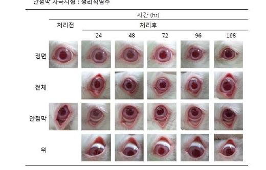 안점막 자극시험 (생리식염수)