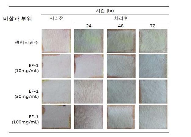 피부자극 시험