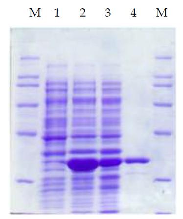 에스테레즈 L28을 대장균 BL21(DE3)에서 발현 및 정제하여 확인한 결과. 1, Induction 전 대장균 조단백질; 2, L28 과다발현 대장균 조단백질; 3, 동일 미생물에서 정제한 Soluble 조단백질; 4, 6XHis Tag을 이용하여 순수 정제한 L28 단백질; M, Size marker.