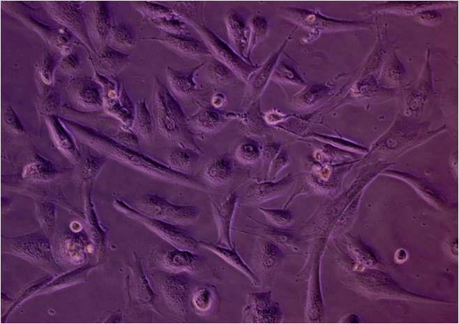 계대배양를 거친 후 줄기세포 완성 단계에서의 세포 배양 모습