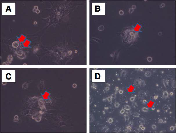 계대배양을 진행하면서 비줄기세포(체세포 및 골격세포)의 세포자살 및 줄기세포와의 분리. (A) 줄기세포 활착에 따른 비줄기세포의 모양 (B) 초기 치조골세포의 배양용기 부착 (C) 배양용기부착 후 활착 모습 (D) 계대배양 직 후의 세포 부착 모습