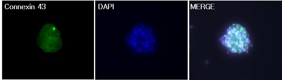 치아줄기세포 분화 방법을 통한 심근세포 분화 결과. 심근유래 유전자인 Connexin 43 항체를 이용하여 반응시킨 후 DAPI로 핵염색을 실시하였음. 두갖 반응 후 두 그림을 Merge시킨 결과 세포의 전체표면에서 심근세포 유래 단백질을 발현시킬 수 있었음.