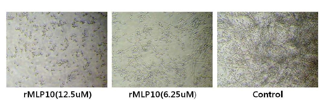 Antifungal activity of recombinant MLP10 on the growth of fungus Candida albicans.