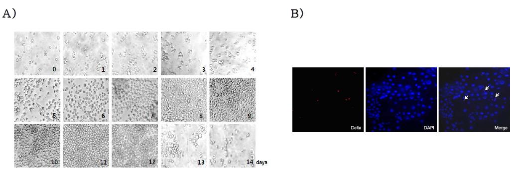 초파리 유래 일차배양 장세포의 날짜별 이미지(A) 및 delta staining 분석(B)