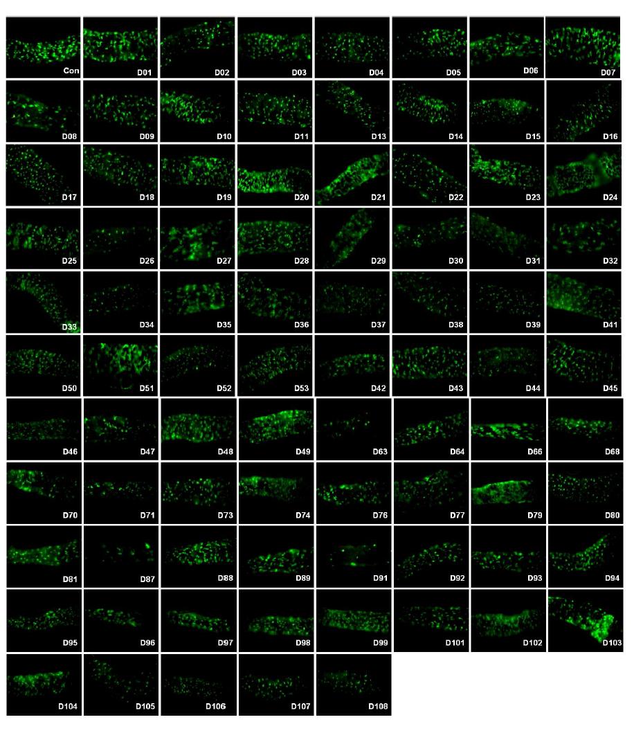 초파리 RNAi 라인에 장손상물질 투여 후 장줄기세포(green) 이미지 확인
