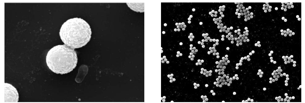 마이크로 자석입자에 포획된 살모넬라 식중독균의 전자현미경 영상