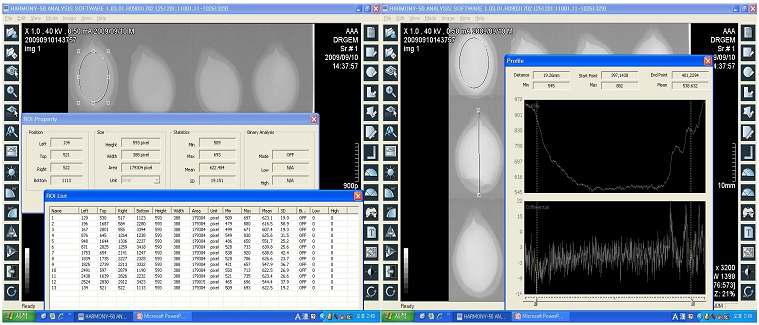 종자 X-ray 이미지의 밀도값을 통한 종자 충실도 검사(좌)와 종자 단면 밀도값을 그래프로 나타내어 씨앗내부의 기계적 상처, 주름 유무를 알아보는 건전도 검사(우)