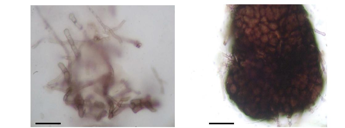 순수 분리된 DSE 내생균주의 현미경적 모습 (좌측 = dark septate hypha, 우측 =micosclerotium, scale bar=30μm)