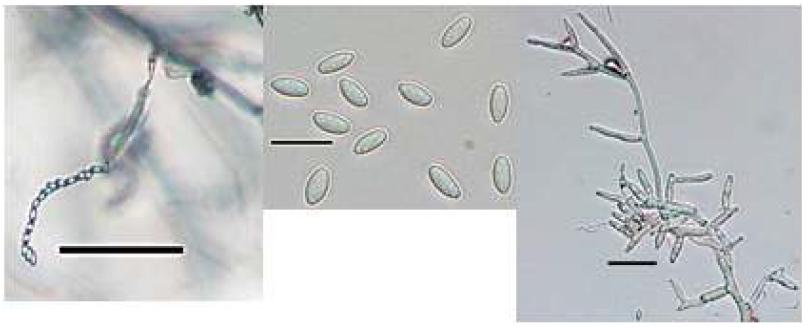 Fusarium lactis의 소형분생포자(좌, 중) 및 분생자경(우)