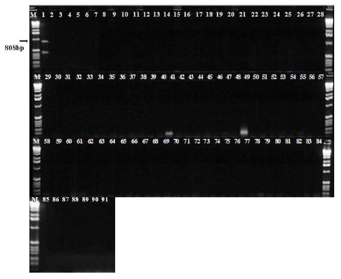 참깨 세균잎마름병균(Xanthomonas campestris pv. sesami) 특이적 PCR primer 조합 선발