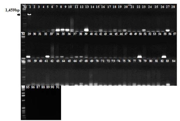 플라타너스 세균궤양병균(Xanthomonas populi) 특이적 PCR primer 조합 선발