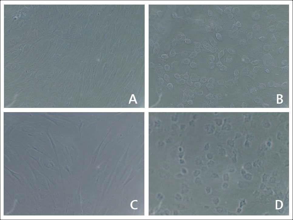 Normal cell과 transfected cell의 morphology 비교 (x100)