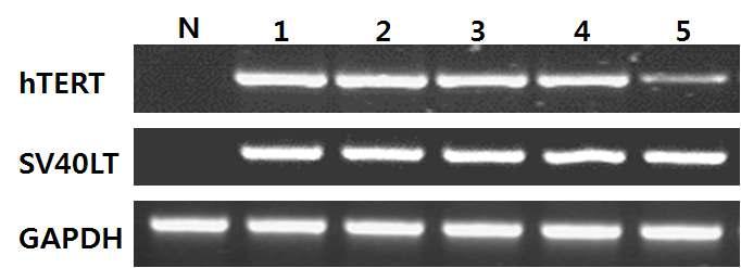 RT-PCR을 이용한 Normal cell과 transfected cells의 hTERT와 SV40LT의 발현비교.