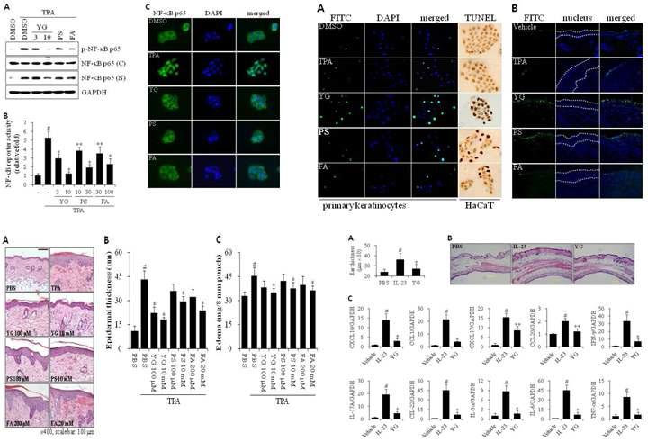 YG의 NF-κB 활성 억제와 세포사멸 유도에 의한 피부질환 치료 작용